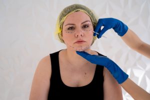 Chirurgie esthétique